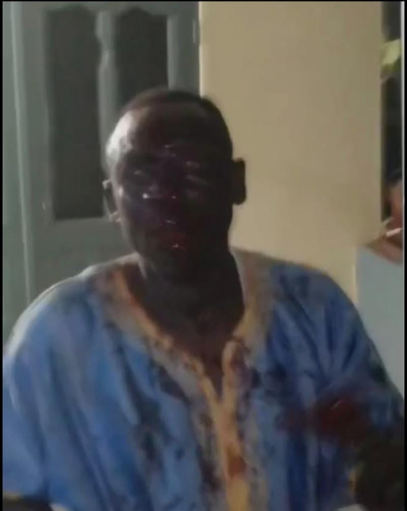 Obuasi SHTS Headmaster Hospitalised After Violent Attack by Students Over Infanticide Allegations